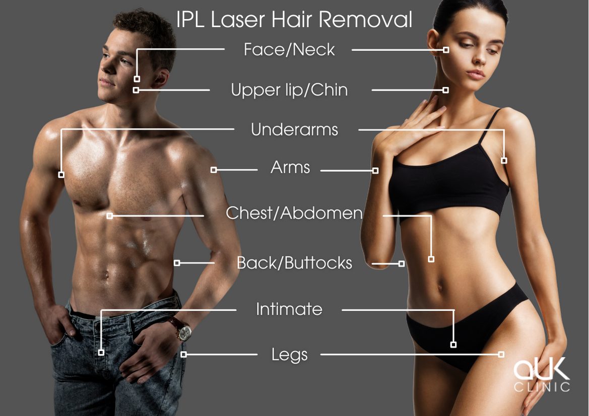Laser Hair Removal - aUK Clinic